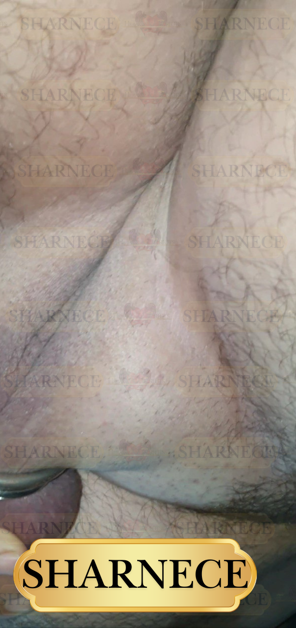 Sharnece